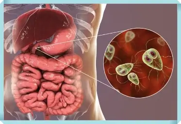 기생충 질환 예방법과 관리 전략에 대한 실용적인 정보를 얻으세요 1 기생충 질환 예방법