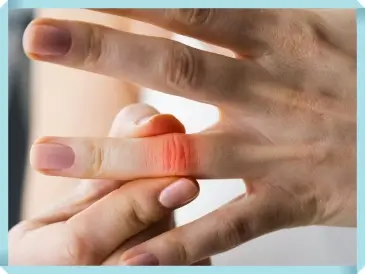 손가락 관절염 증상 및 통증 각종 동작 제한 관절 부종 1 손가락 관절염 증상 및 통증