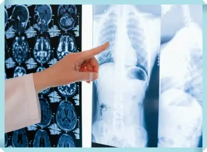 폐 질환 폐 건강을 유지하기 위한 중요한 팁과 예방법 2 폐질환 검사 결과