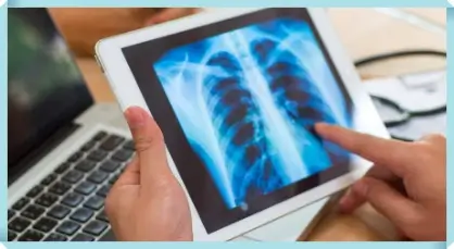 폐 질환 폐 건강을 유지하기 위한 중요한 팁과 예방법 1 폐질환 폐건강 관련